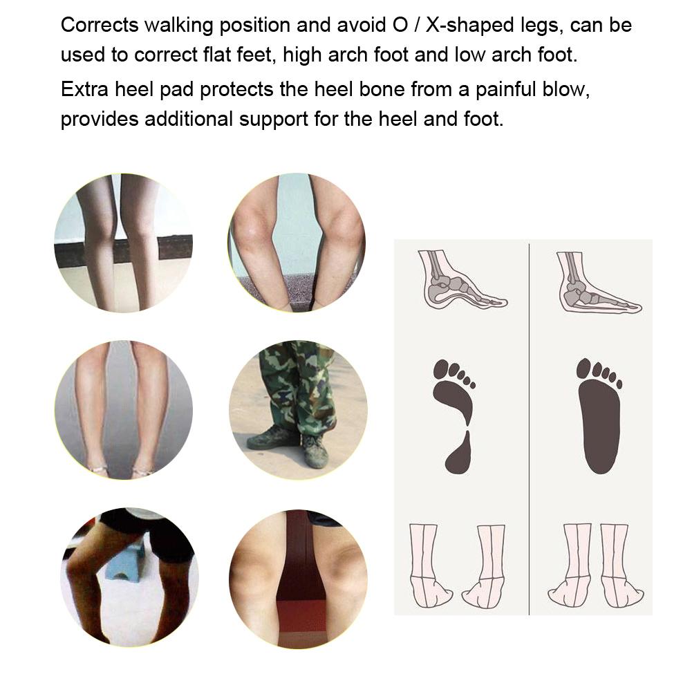 Orthopedic Insole X/O Shape Leg Correction Flat Foot Arch Support Foot Massager