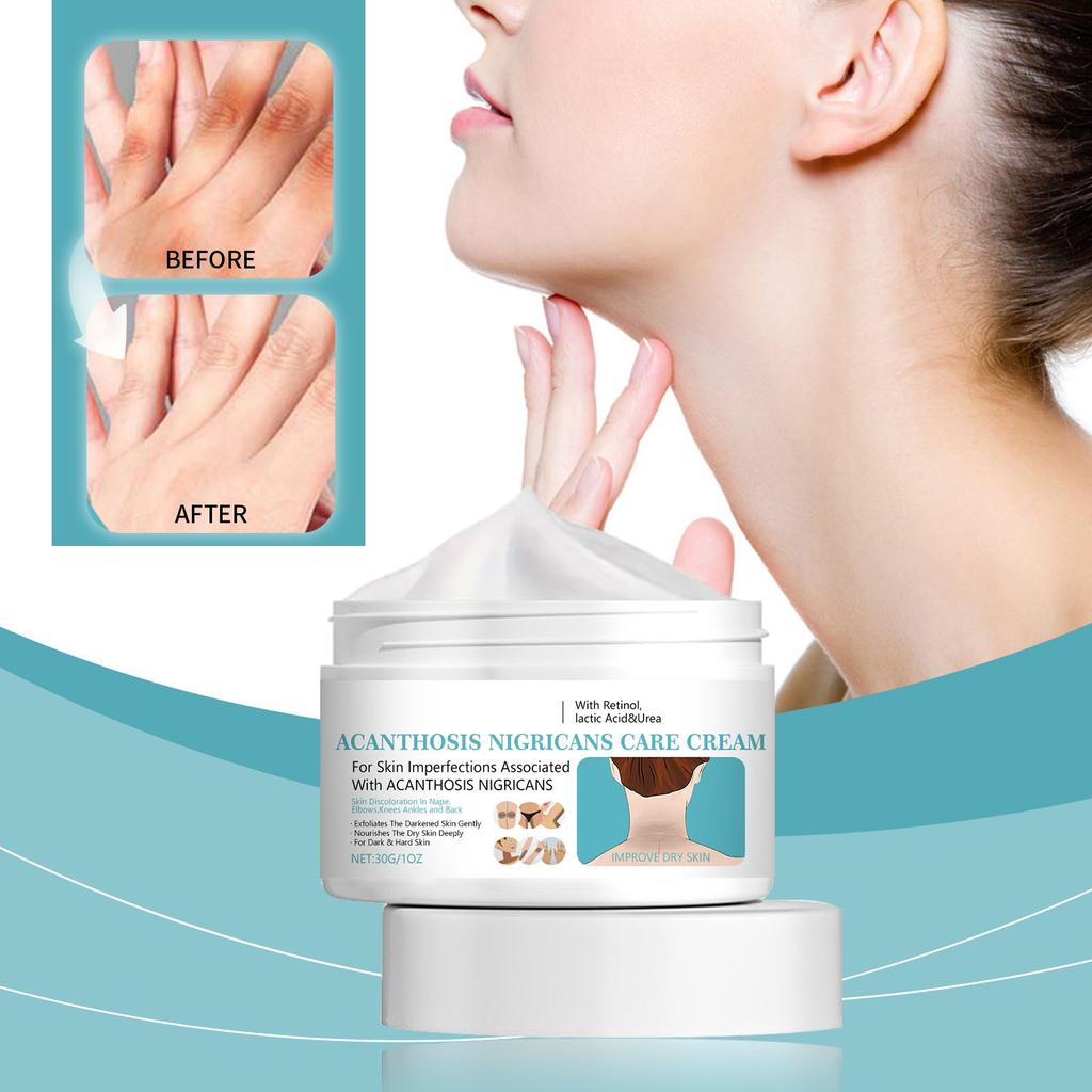 Крем Acanthosis Nigricans, крем для подмышек, крем-корректор темного цвета для удаления гиперпигментации, крем для шеи, лодыжек.
