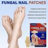 2025 Fungus Patch Waterproof Nail Repair Patches, Ingrown Nail Correction Stickers, 1/2/3/4/5pcs for Discolored or Damaged Nails