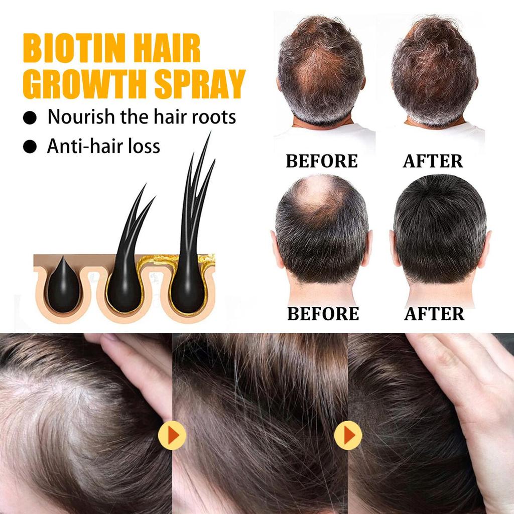EELHOE Biotin Hair Growth Spray 30ml Scalp Repair Serum Nourish Damaged Hair Thicken Hair Care for Men Women