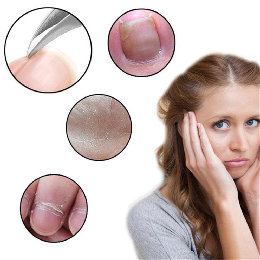 Щипцы для коррекции ногтей Машинки для стрижки кусачек Для удаления омертвевшей кожи Подиатрия Педику