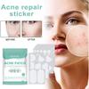 132Pcs/Pack Acne Pimple Patches Ultra-Thin Invisible Acne Removal Patches Covering Blemishes Zit Patches Face Acne Treatment Spot Zit Stickers