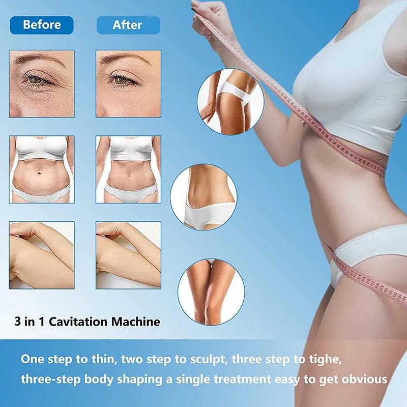 3в1 лазерная радиочастота RF 40K кавитация Lipo для похудения ультразвуковая липосакция кавитационная машина для подтяжки кожи формы тела