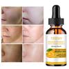 Orange Vitamin C Vitalizing Essence Soft, Smooth and Moisturizing Essence Water Skin Soothing, Repairing and Supplementing Vitamin Whitening Lotion