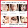 Newest Dark Spots Corrector Cream Whitening Facial Cream Repair Fade Freckles Remove Dark Spots Melanin Remover Brightening Face Cream