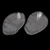 1 Pair Fit Size Forefoot Pad Shock Proof Useful Men Flip Flops Insole Half Size Toe Separator Shoe Cushion