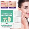 Pimple Patches For Face,Zit Covers,Hydrocolloid Acne Patches Zits Cover Stickers 4 Size With Tea Leaf Oil, Hedyotis Alba Extract
