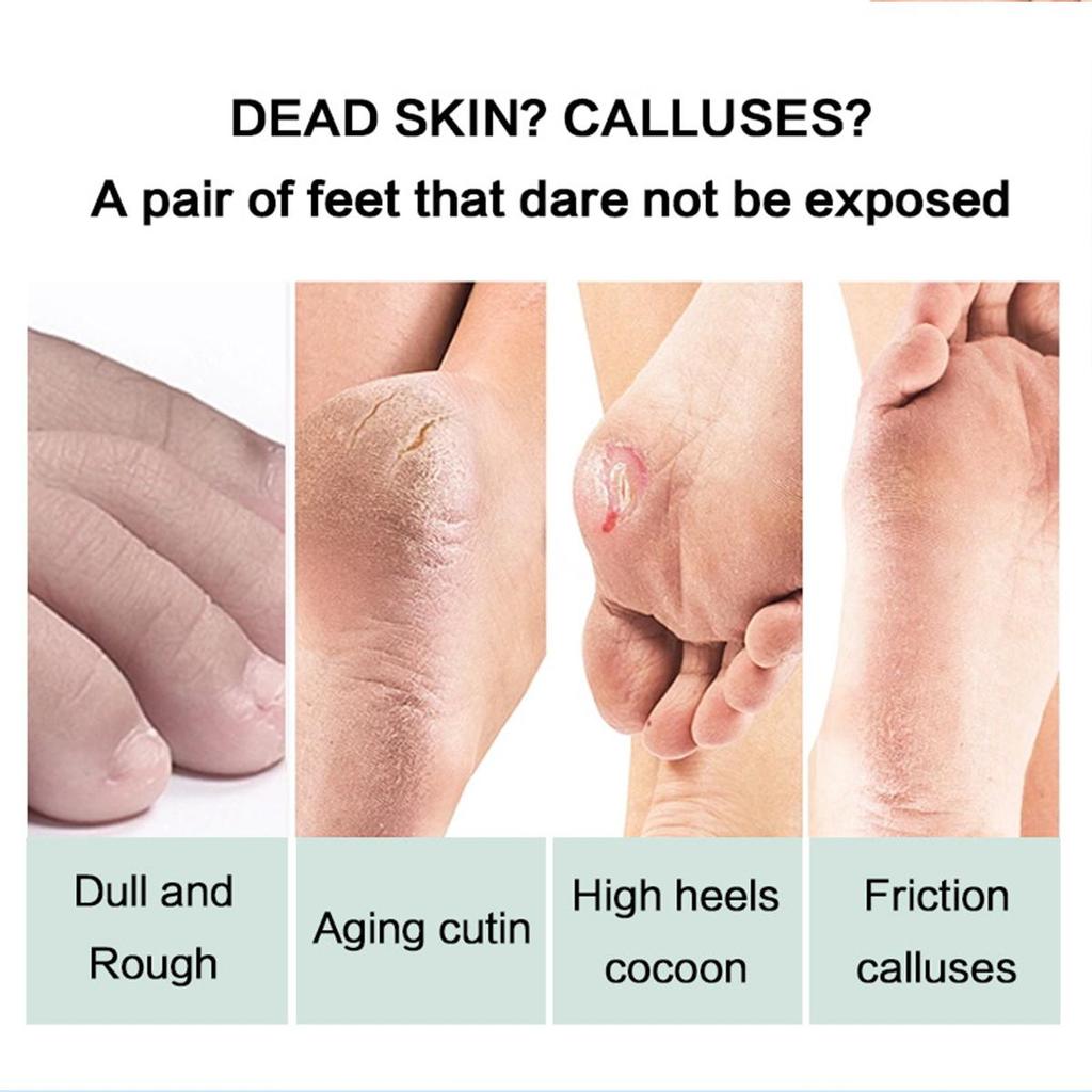 Moisturizing Foot Cream, Suitable for Extremely Dry, Cracked, and Rough Skin, Deep Moisturizing and Nourishing Skin Moisturizer