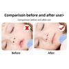 Prevent Open Mouth Sleep Anti-Snoring Mouth Tape Shut Up Stickers  Kids/Children