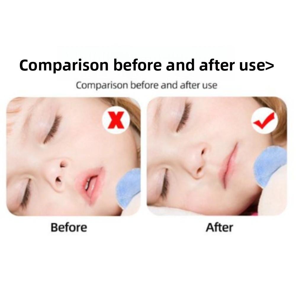 Prevent Open Mouth Sleep Anti-Snoring Mouth Tape Shut Up Stickers Kids/Children