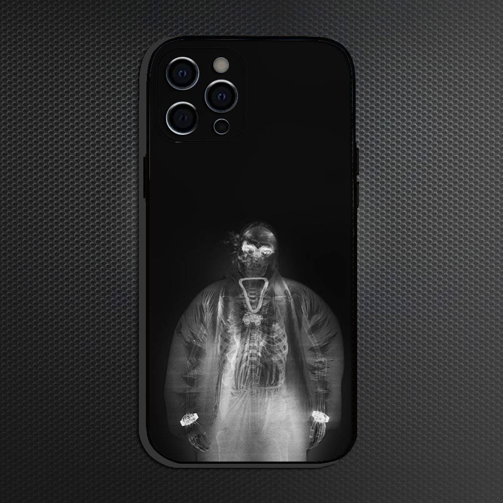 Чехол для телефона Y-Yeat Rapper AfterLyfe Для iPhone 16,15,14,13,12,11 Plus,Pro Max, Мягкий силиконовый черный чехол