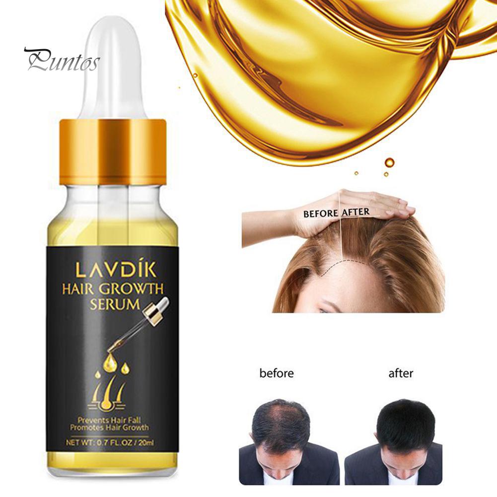 Puntos LAVDIK 20 мл Сыворотка для роста волос Эфирное масло Ремонт поврежденной питательной жидкости