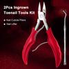 2Pcs Ingrown Toenail Tools Kit Stainless Steel Nail Cuticle Pliers Ingrown Nails Clipper Lifter Fingernail Toenail