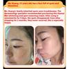 Whitening and Freckle Removing Cream Face Cream Lightening and Removing Spotles Sunburn Brightening Skin Color