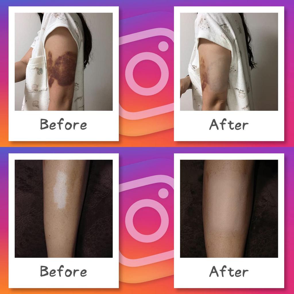 Лента для фундамента (лента, скрывающая риски для кожи), стандартный размер, одного цвета, 10 штук, скрытый вырез на запястье, водонепроницаемые, сделано в Японии (розовая охра)