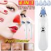 Всасывающий очиститель пор для лица, вакуумный электрический экстрактор для удаления черных точек, 4 в 1