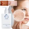Brightening Blemish Cleanser Deep Oil Control Cleansing Pore Fading Blemish Acne Marks Hydrating Moisturizing Skin