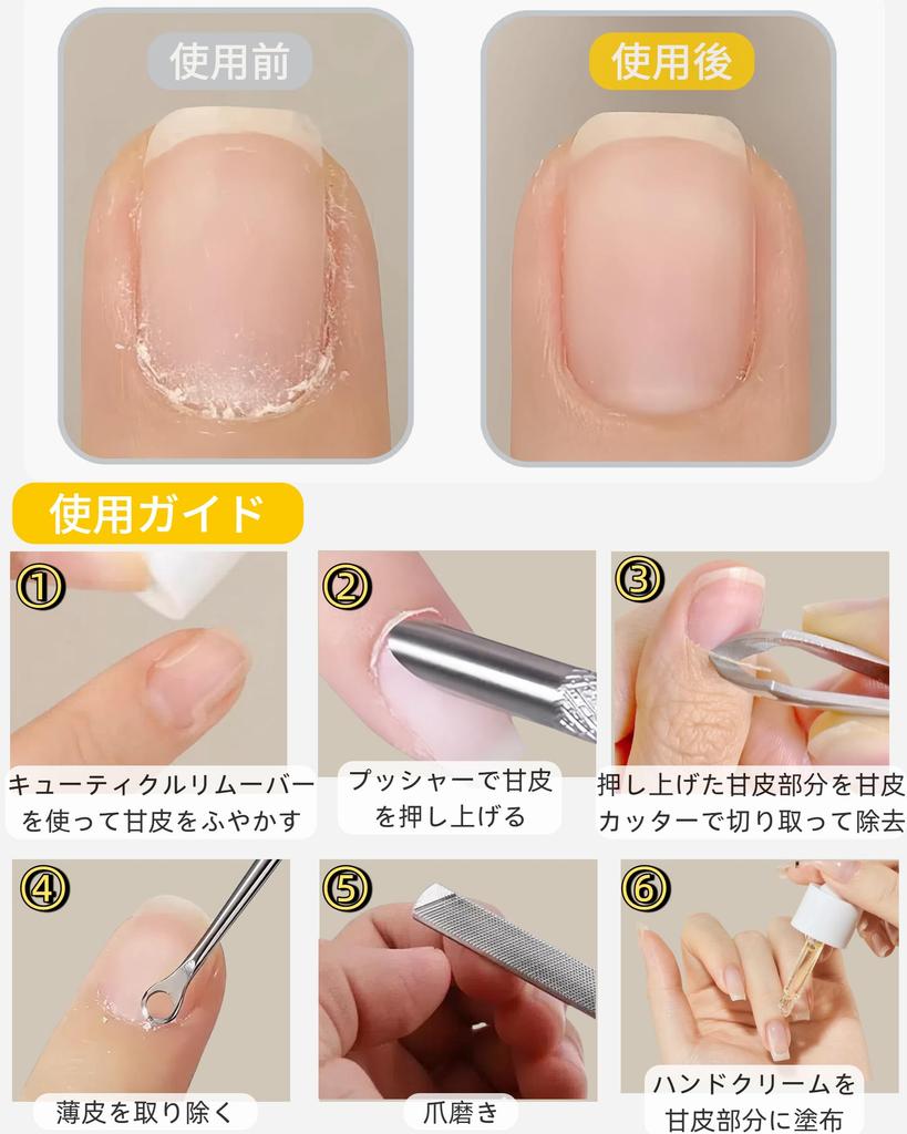KERURU Cuticle Care Set of Includes Nail Nail Cuticle Nail Dirt Nail and Cuticle Made of Stainless for Ingrown Nail Gel Nail Hangnail and Nail Care