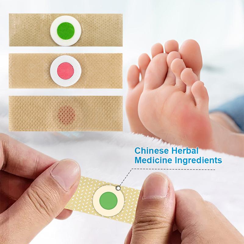6/12/18/24/30/36 шт. Пластырь для удаления мозолей и натоптышей на ногах, подушечки для мозолей, пластыри, аксессуары для обуви, средства для ухода за ногами
