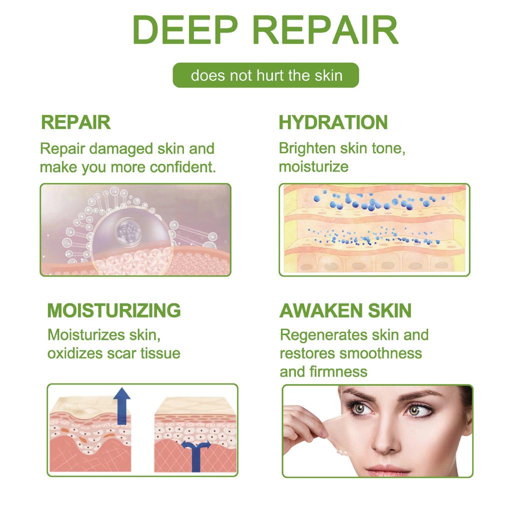 1 шт. 150 см силиконовый гелевый пластырь для лечения шрамов лента для удаления акне травма ожог шрам покрытие для восстановления кожи раздел ухо красота