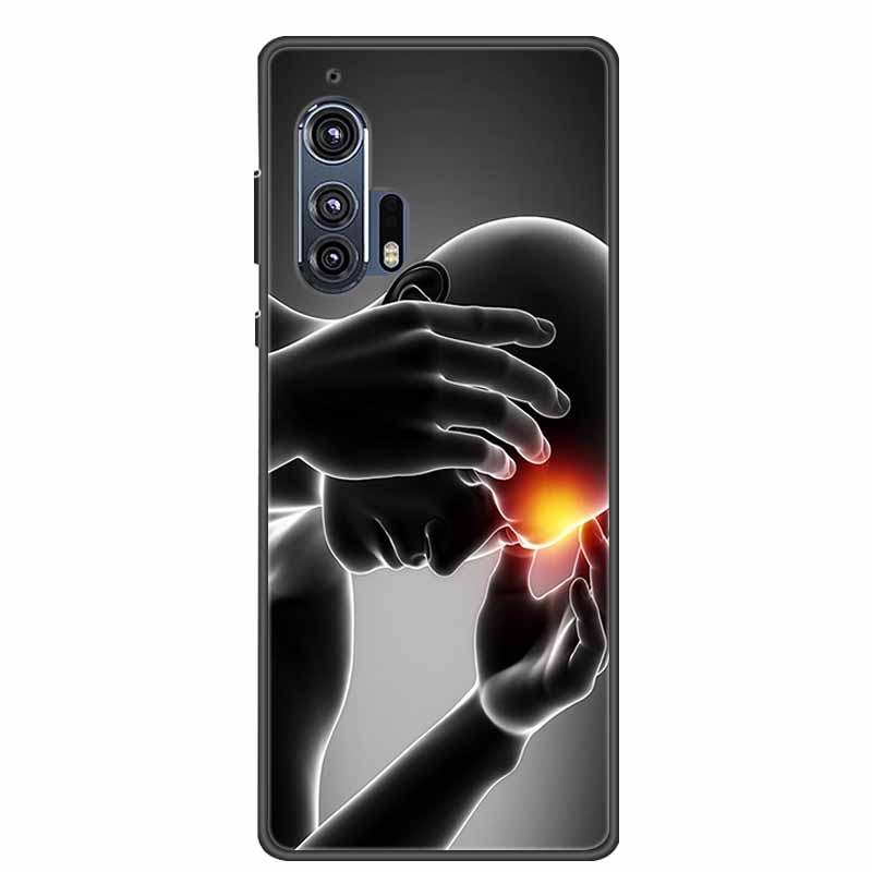 6.7" Чехол для Motorola Moto Edge Plus Новый Фото Черный Силикон Мягкая Задняя Крышка Чехол Для Motorola Edge Plus 2020 Чехол для Телефона Capa