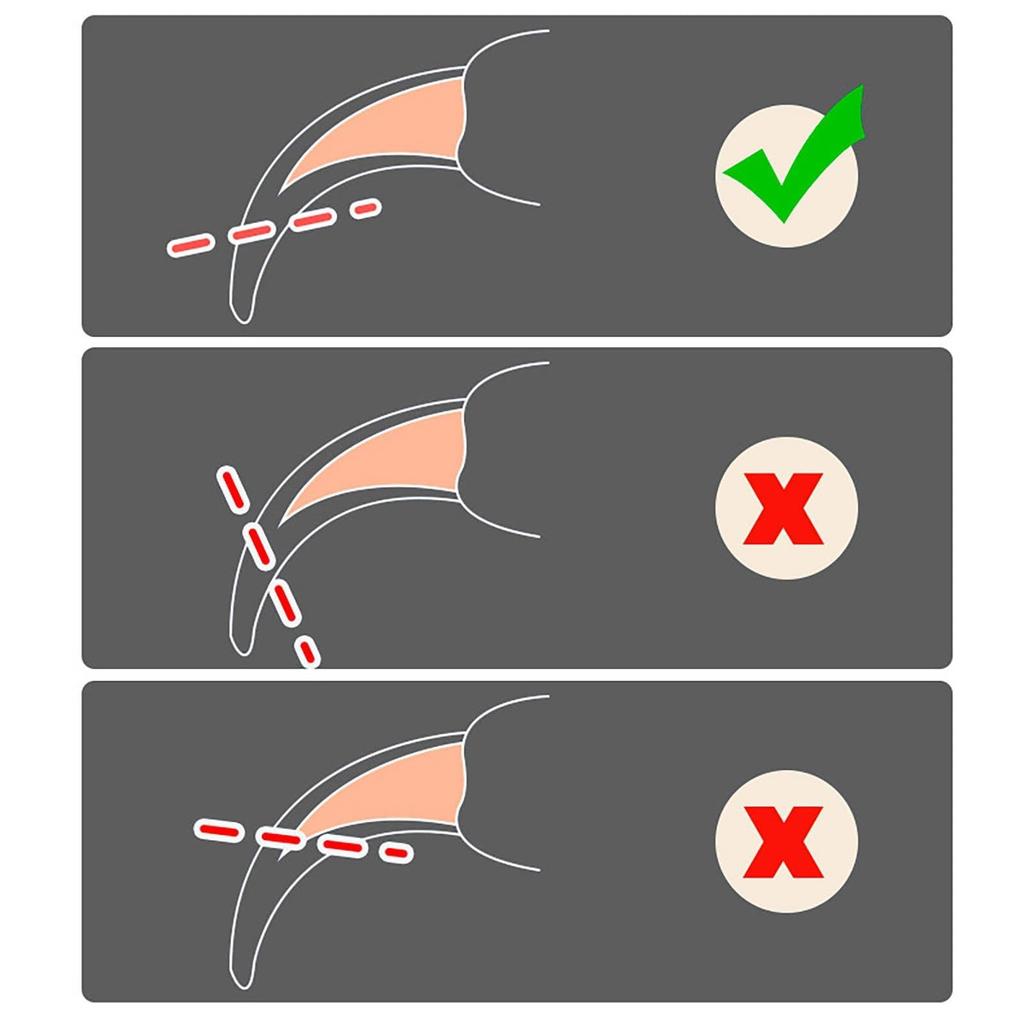 Risingvent Pet Cat Nail Clipper Устраняет выпадение шерсти, в то время как удаление шерсти у кошек и собак Чистка домашних животных Длительная безболезненная щетка для домашних животных Щетка, набор, массаж, щетка, щетка,