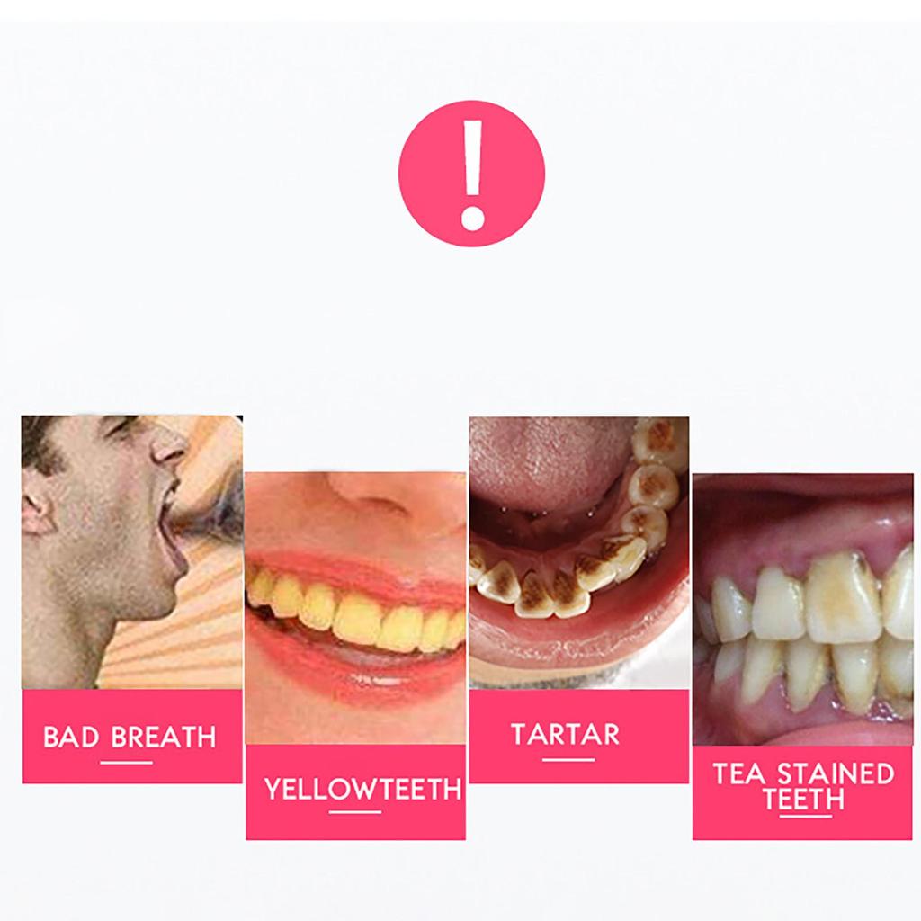 Электрический многофункциональный полировщик зубов, который облегчает зуб, 3 уровня вибрации