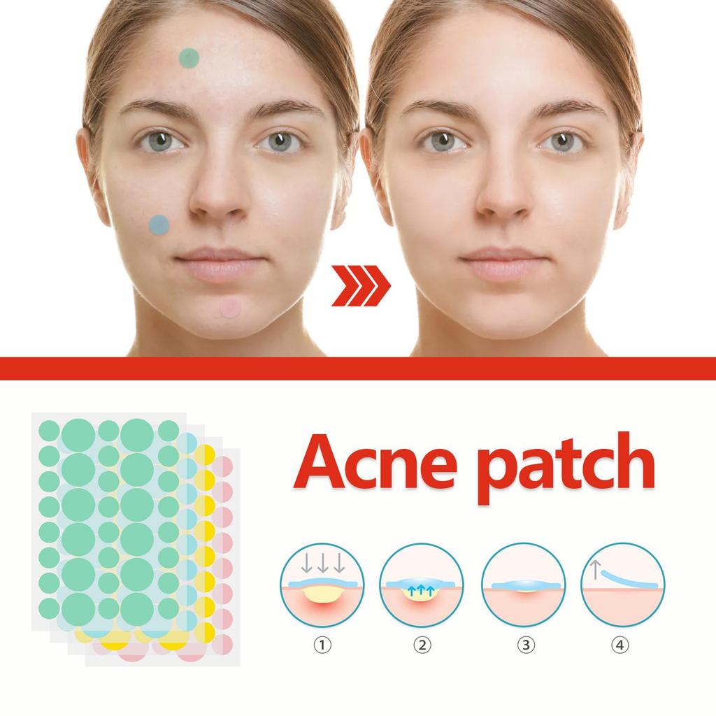 EELHOE Пластырь от прыщей Colorful Acne Patch мягко и не вызывает раздражения, осветляет прыщи и улучшает состояние кожи, склонной к акне.