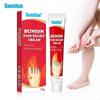 Bunion Relief Cream, Bunion Pain Relief Cream, Bunion Pain Relief For Toe Pain Relief Stiffness