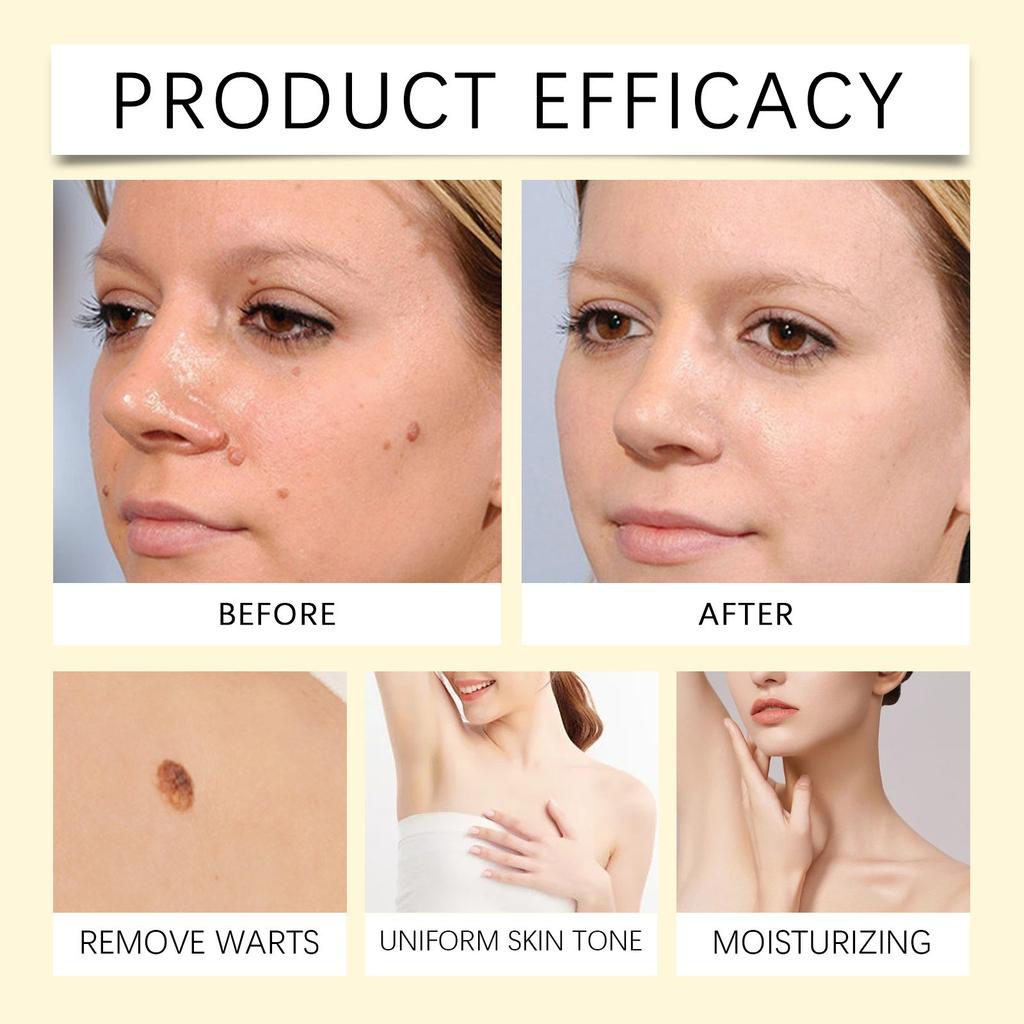 Крем для ухода за кожей нежно питает и увлажняет кожу ежедневно, облегчая дискомфорт кожи