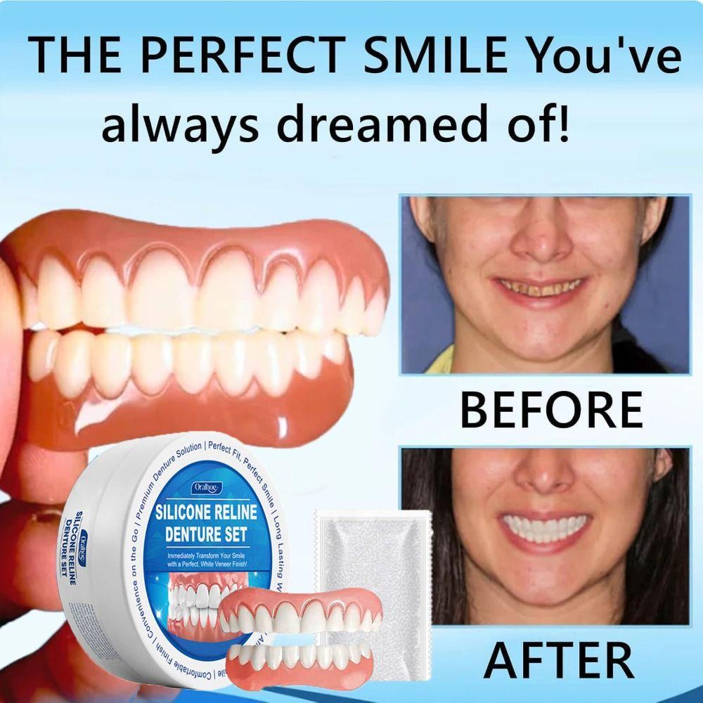 Soft Denture Silicone Reline Kit Silicone Instant Teeth New Denture Reline Kit For Men And Women