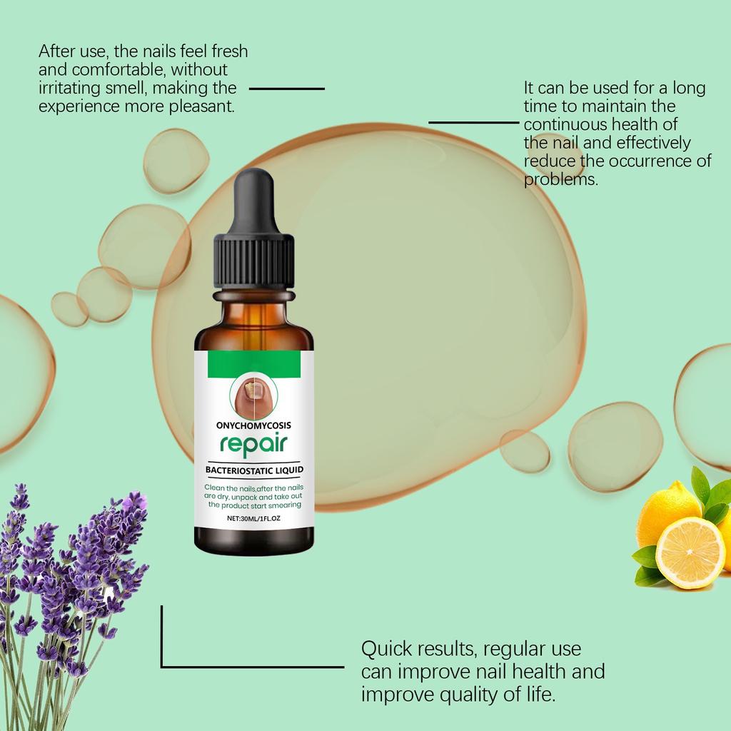 Масло для роста ногтей Leuconychia Масло для ногтей Mycosis Care For Nail Mycosis Foot Mycosis Red Brown Foot 30ML