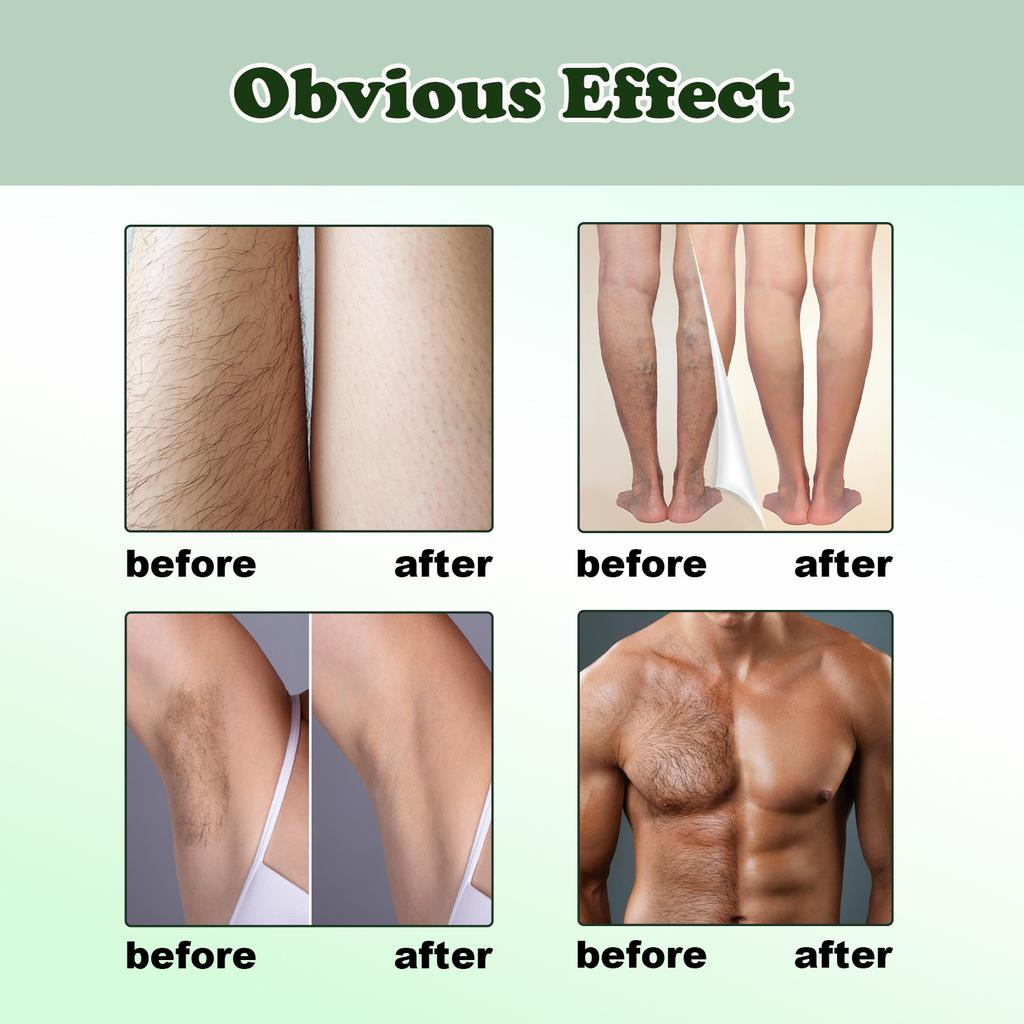 30ml Hair Removal Spray, 8 Minutes Hair Removal Spray Natural Body Hair Remover, Gently Inhibits Hair Growth For Arm, Legs, Armpits, Armpits