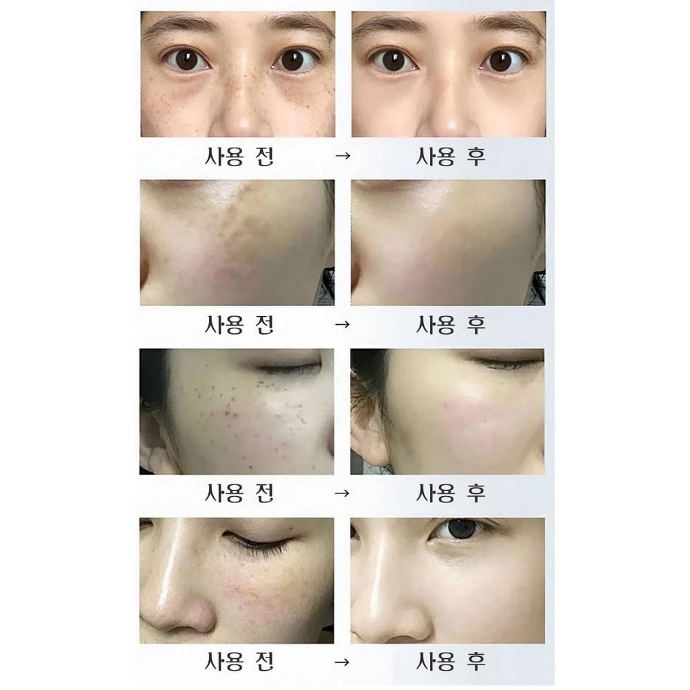 [1/1+1] Brightening Spot Sebum-removing Peel-off Pack, Pore-shrinking, Pure Gold Modeling Pack, 100mlx2