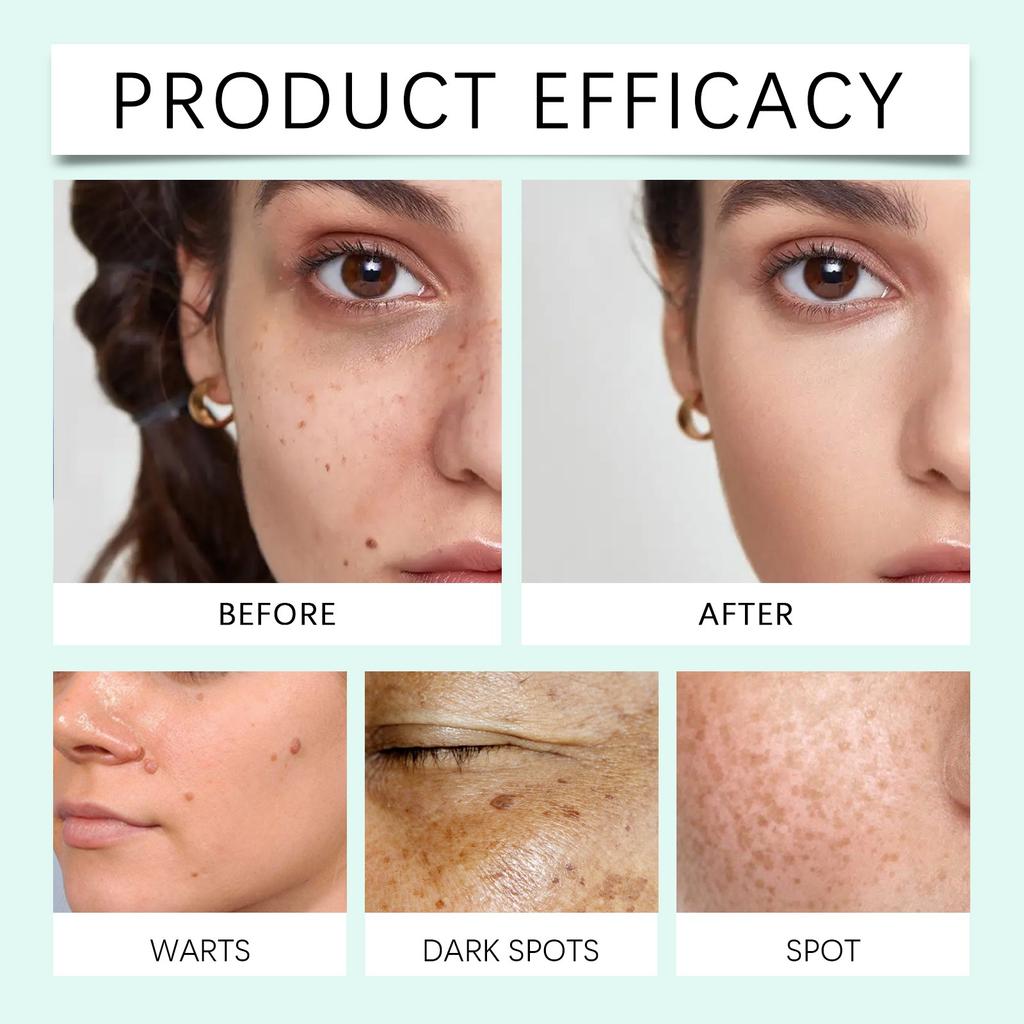 Гель для ухода за кожей тела Увлажняющий, разглаживающий и осветляющий крем для ухода за родинками