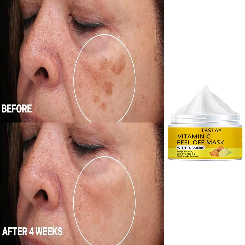 Осветляющий и полупрозрачный крем для кожи с пигментными пятнами, мягкое увлажнение без раздражения, уменьшает мелкие морщины, увлажняет кожу и улучшает состояние поврежденной кожи.