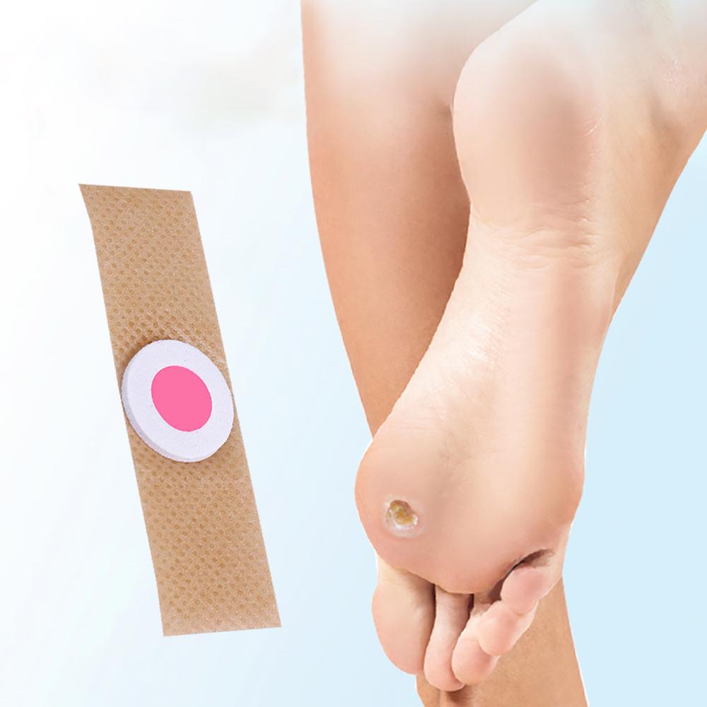 Foot Corn Removal Killer Calluses Plantar