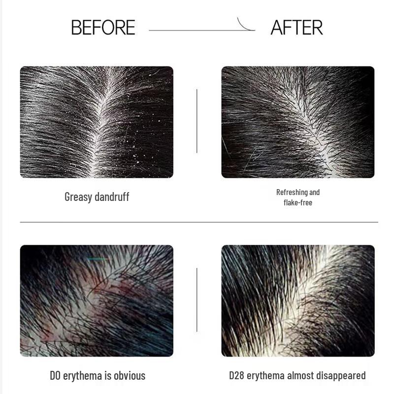 Spes Bisabolol Peptide Hair Care Set