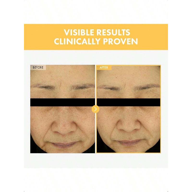 Tosowoong Eraser Liquid Patch 15g | Niacinamide, Tranexamic Acid & Centella Asiatica Extract Infused, Targeted Blemish Treatment