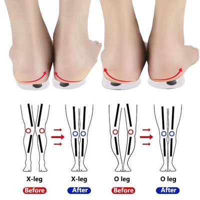 1 пара магнитов, силиконовые ортопедические стельки, инструмент для ухода за ногами для мужчин и женщин, здравоохранение, O/X тип, ноги, коррекция варусной деформации колена, подпяточники