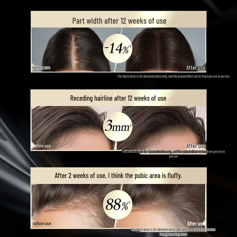 Schwarzkopf Набор: Шампунь и сыворотка против выпадения и для укрепления волос