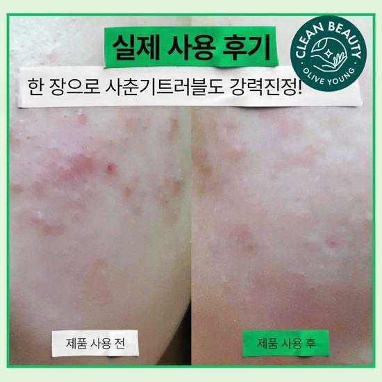 Epilow Houttuynia cordata Hyalusica Успокаивающие подушечки для проблем Большая емкость 100 листов