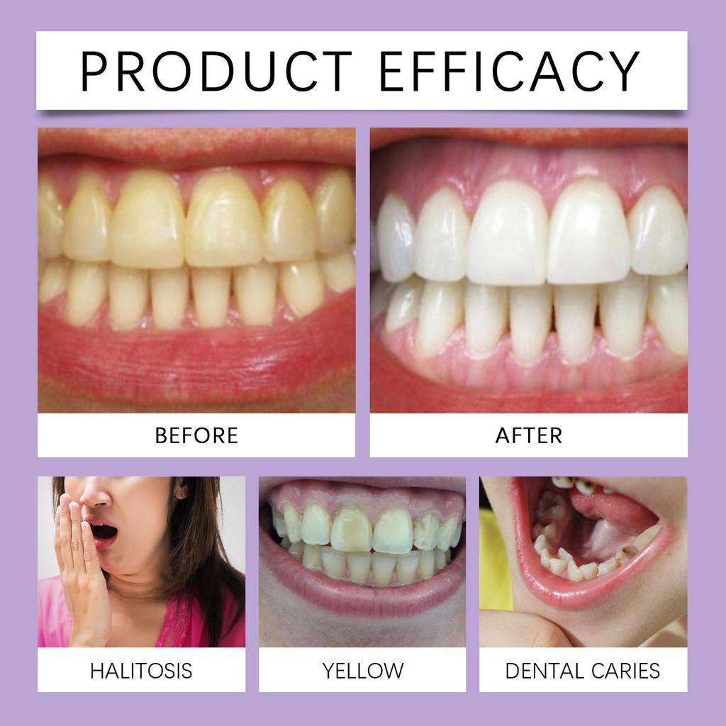 Oralhoe Фиолетовый гель для ухода за деснами Глубокая очистка Пятна Бережный уход за деснами Уход за зубами