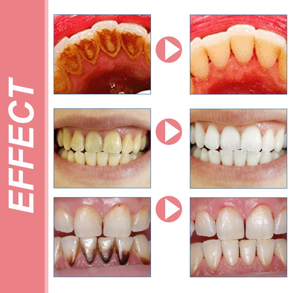 EELHOE Очищение зубов, отбеливающий мусс, зубная паста для глубокой очистки, пена, зубная паста удаляет пятна, свежее дыхание, инструменты для ухода за зубами, 100 г