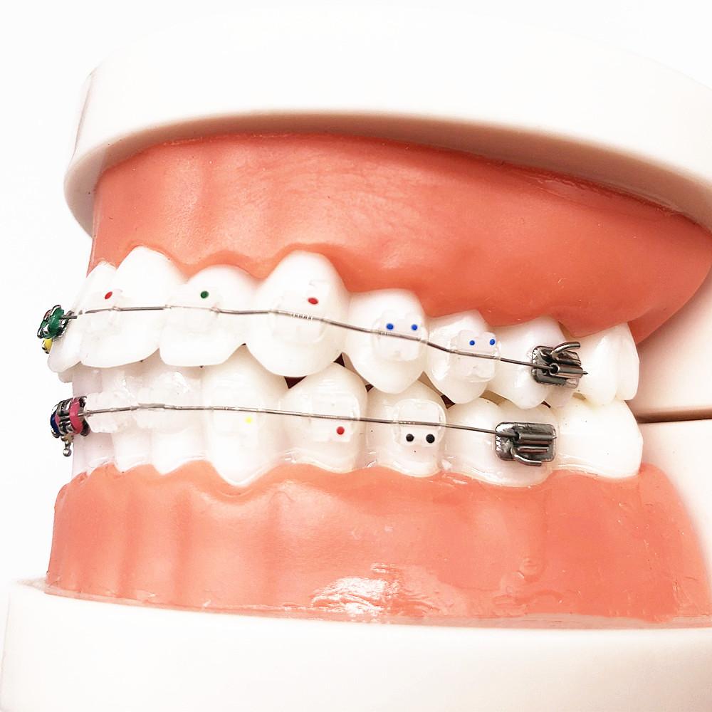 1 шт., стоматологическая модель для ухода за полостью рта, стоматологическая ортодонтическая модель для общения с пациентом, модель для исследования стоматолога