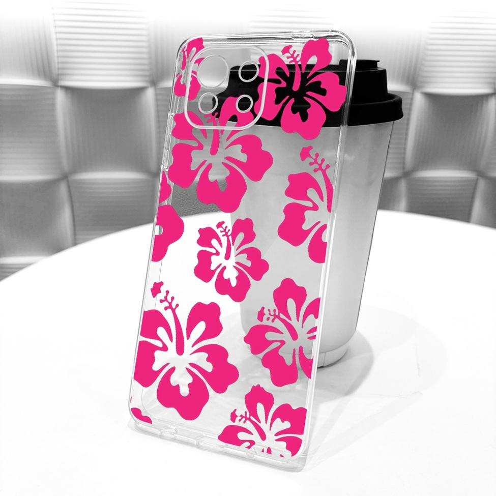 Clear Casing For Xiaomi Mi 11 Lite 4G Cover For Xiaomi Mi 11 Lite 5G Case Cute Cat Fashion Butterfly Funny Painted