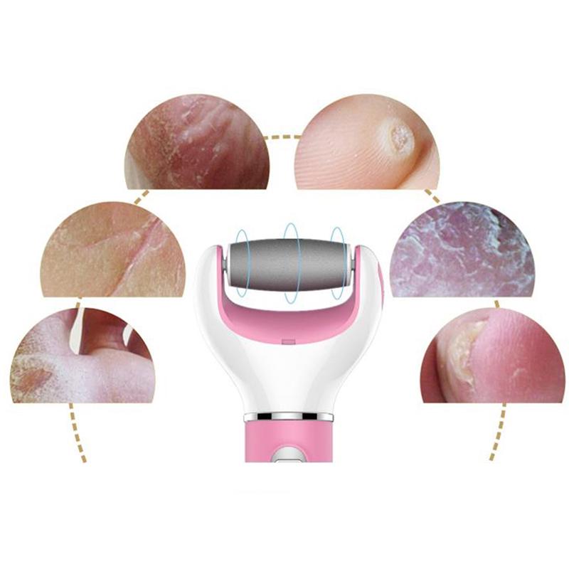 1Pcs Electric Callus Remover Tool Pedicure Foot File Care Hard Dead Dry Cuticle Skin