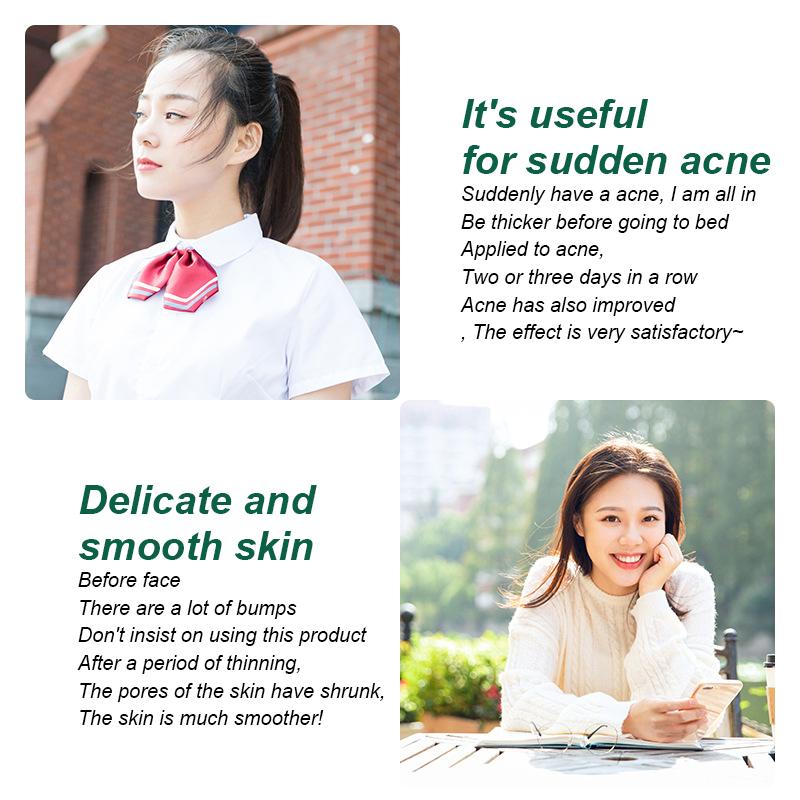 Эссенция салициловой кислоты, гель для удаления шрамов от прыщей, выцветание, удаление пигментации кожи, успокаивающая, предотвращающая лечение акне, сыворотка-эссенция, 20 г