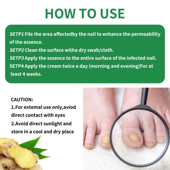 30ml Nail Growth Serum Ginger Nail Treatment Nail Growth Repair Essential Oils