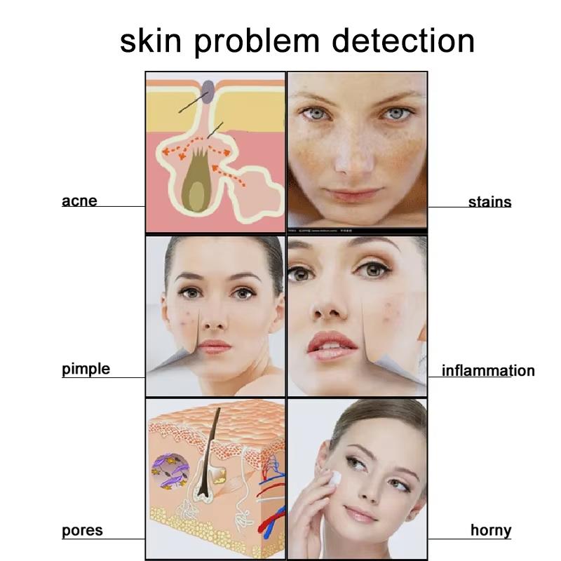 50X/200X анализатор волосяных фолликулов кожи головы обнаружение увеличительный микроскоп ЖК-цифровой дерматоскоп детектор тестер волос на коже головы